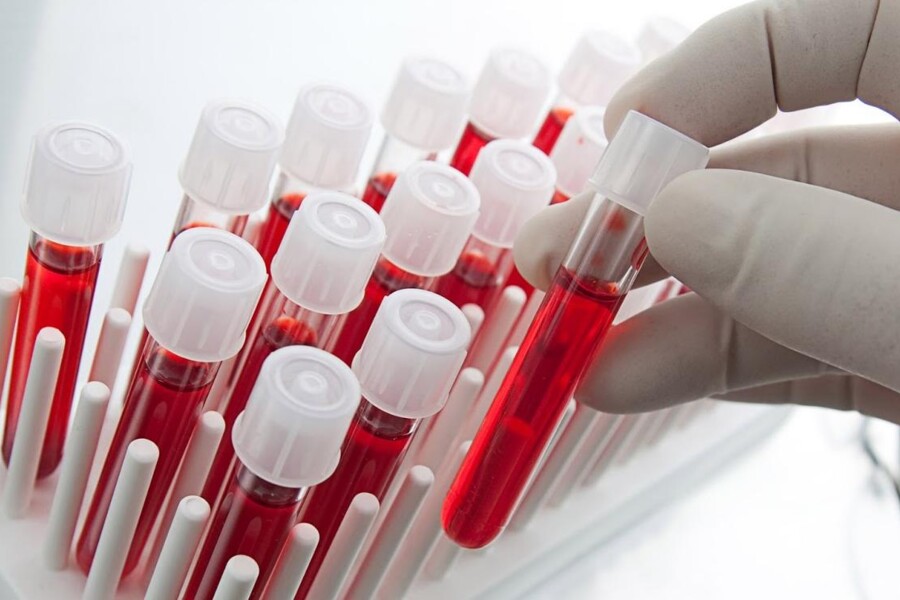 Screeningové testy novorozenců