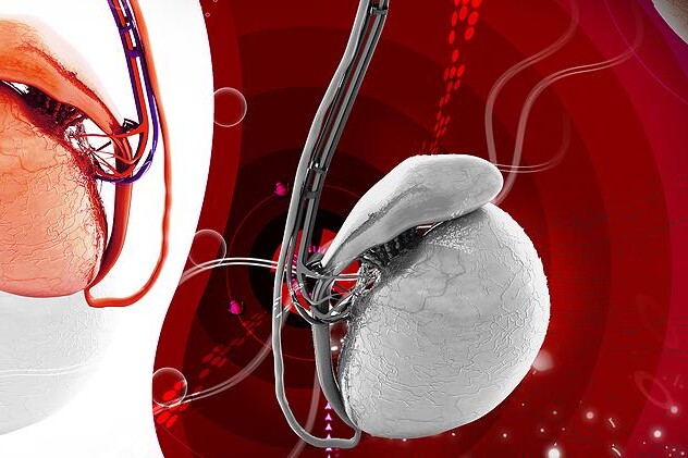 Varlata a nadvarlata  