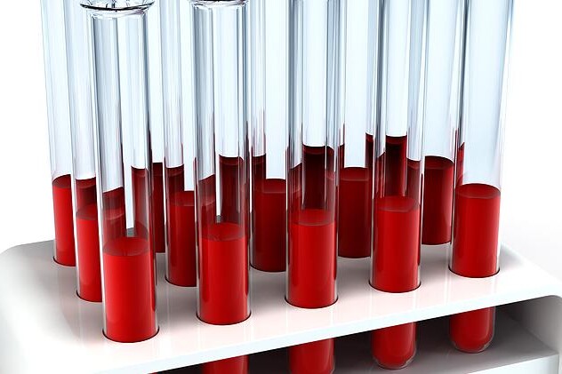 Ferritin