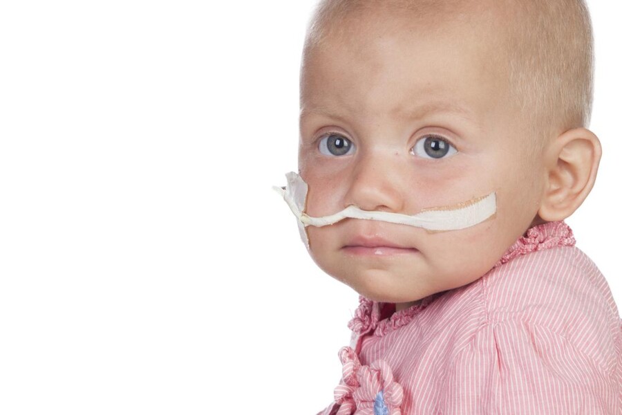 Rabdomyosarkom u dětí