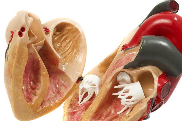 Fallotova tetralogie