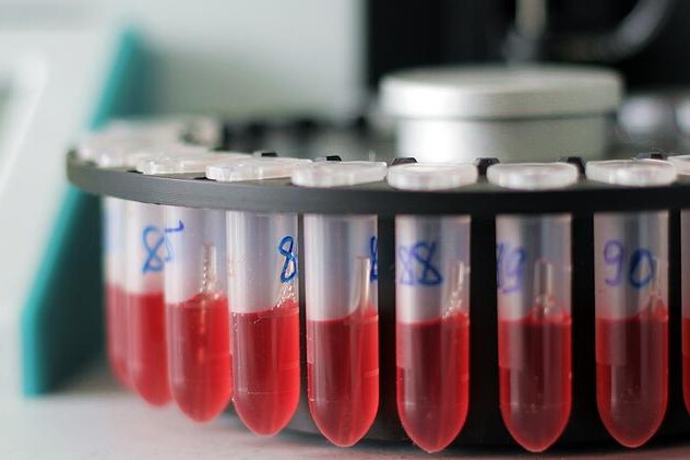 Hematokrit