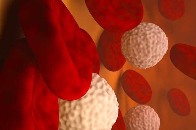 Leukemie