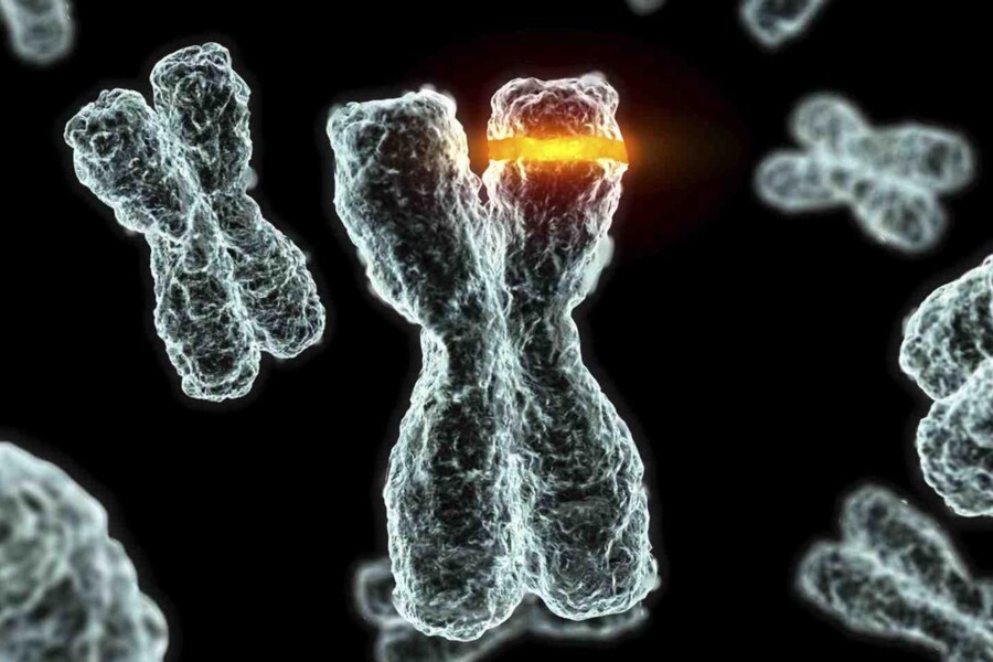 Syndrom křehkého chromozomu X u dětí