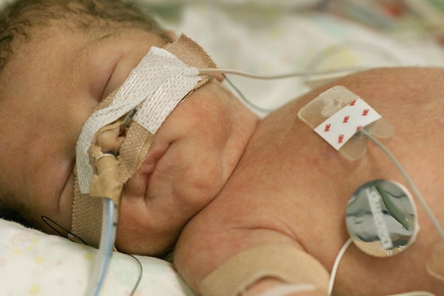 Guillainův-Barrého syndrom