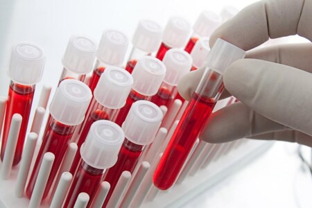 Screeningové testy novorozenců