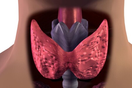 Tyroiditida u dětí