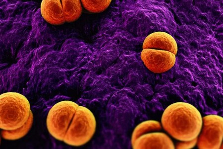 Záněty mozkových blan - meningitidy 