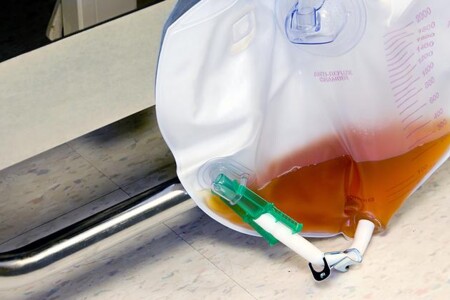 Co dělat při retenci moči…?