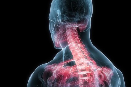 Bolesti krční páteře