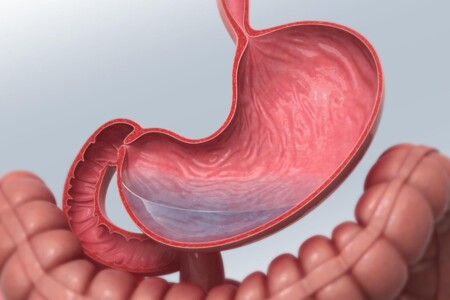 Peptické vředy u dětí