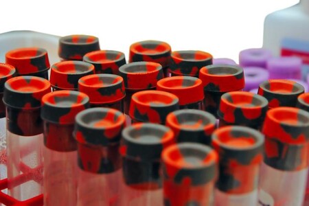 Příznaky těhotenské cukrovky 