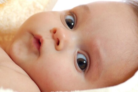 Vrozené deformity obličeje