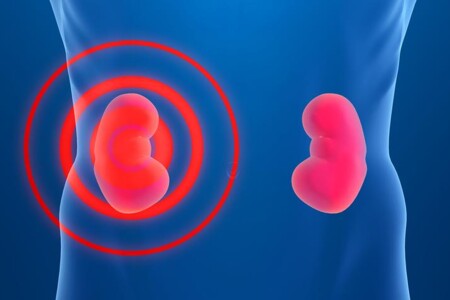 Chronické selhání ledvin