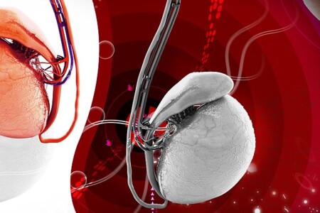 Varlata a nadvarlata  