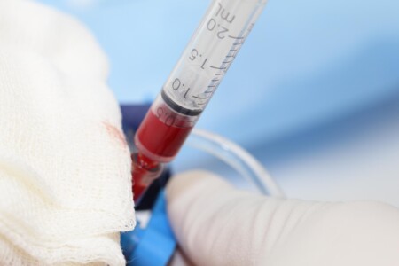 Testy a screeningová vyšetření u dětí