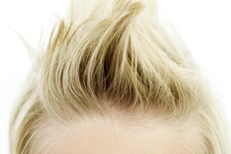 Zánět pokožky ve vlasové části hlavy u dětí