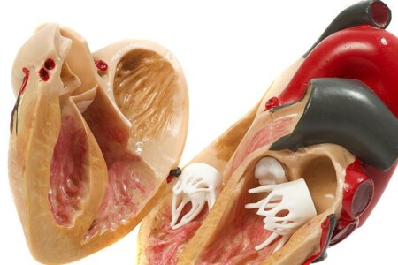 Fallotova tetralogie