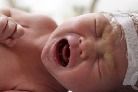 Periventrikulární leukomalacie