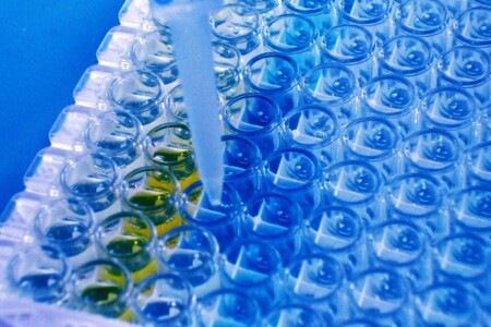 Infekční mononukleóza