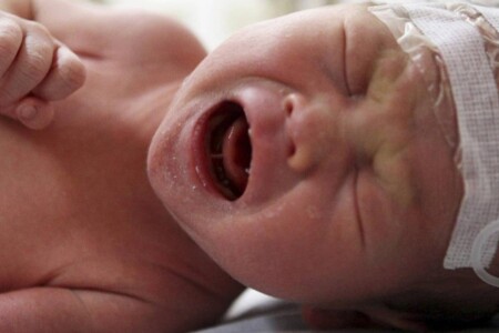 Nekrotizující enterokolitida