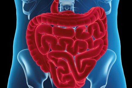 Vchlípení střeva u dětí